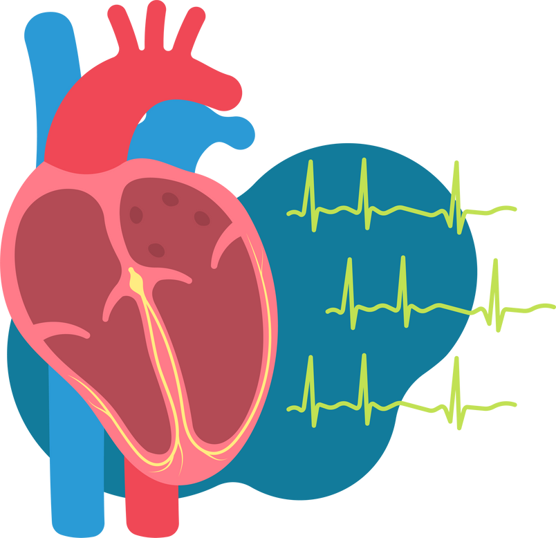 attack rhythm stroke surgery congenital surgical pacemaker heart Atrial defect flutter